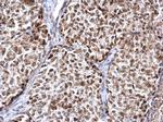 FEN1 Antibody in Immunohistochemistry (Paraffin) (IHC (P))