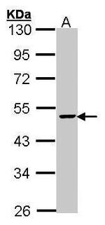 FEN1 Antibody in Western Blot (WB)