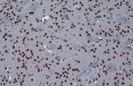 hnRNP K Antibody in Immunohistochemistry (Paraffin) (IHC (P))