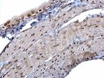 hnRNP K Antibody in Immunohistochemistry (Paraffin) (IHC (P))