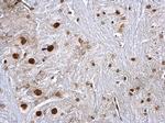 hnRNP K Antibody in Immunohistochemistry (Paraffin) (IHC (P))