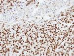 hnRNP K Antibody in Immunohistochemistry (Paraffin) (IHC (P))