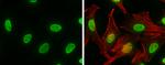 hnRNP K Antibody in Immunocytochemistry (ICC/IF)