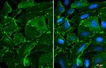 EPB41L3 Antibody in Immunocytochemistry (ICC/IF)