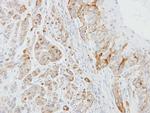 EPB41L3 Antibody in Immunohistochemistry (Paraffin) (IHC (P))