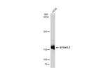 EPB41L3 Antibody in Western Blot (WB)