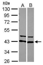 hnRNP D Antibody in Western Blot (WB)