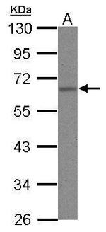 hnRNP K Antibody in Western Blot (WB)