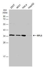 RPL5 Antibody in Western Blot (WB)