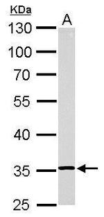 RPL5 Antibody in Western Blot (WB)