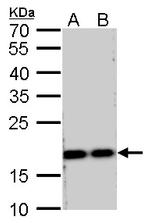 RPS15 Antibody in Western Blot (WB)