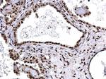 SNRPD2 Antibody in Immunohistochemistry (Paraffin) (IHC (P))