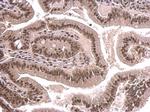 SNRPD2 Antibody in Immunohistochemistry (Paraffin) (IHC (P))