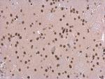 SNRPD2 Antibody in Immunohistochemistry (Paraffin) (IHC (P))