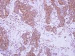 CD79b Antibody in Immunohistochemistry (Paraffin) (IHC (P))