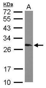 SNRPB Antibody in Western Blot (WB)