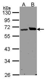 Ribophorin I Antibody in Western Blot (WB)