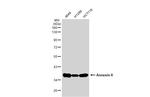 Annexin A2 Antibody in Western Blot (WB)