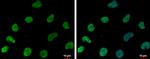 DNAJB6 Antibody in Immunocytochemistry (ICC/IF)