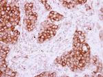 PHGDH Antibody in Immunohistochemistry (Paraffin) (IHC (P))