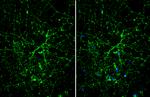 TPH2 Antibody in Immunocytochemistry (ICC/IF)