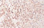 TPH2 Antibody in Immunohistochemistry (Paraffin) (IHC (P))