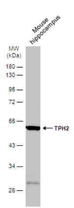 TPH2 Antibody in Western Blot (WB)