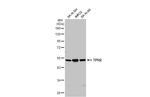 TPH2 Antibody in Western Blot (WB)