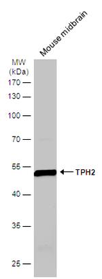 TPH2 Antibody in Western Blot (WB)