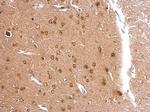 APLP2 Antibody in Immunohistochemistry (Paraffin) (IHC (P))