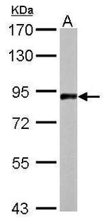 APLP2 Antibody in Western Blot (WB)