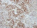 RAP1 Antibody in Immunohistochemistry (Paraffin) (IHC (P))