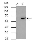 RAP1 Antibody in Immunoprecipitation (IP)