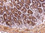 TRAP1 Antibody in Immunohistochemistry (Paraffin) (IHC (P))