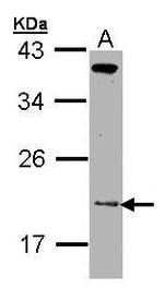 ZNHIT1 Antibody in Western Blot (WB)