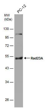 RAD23A Antibody in Western Blot (WB)