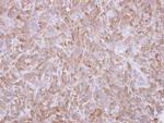 Profilin 1 Antibody in Immunohistochemistry (Paraffin) (IHC (P))