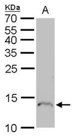 Profilin 1 Antibody in Western Blot (WB)