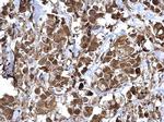 NFkB p65 Antibody in Immunohistochemistry (Paraffin) (IHC (P))