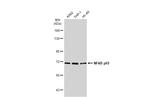 NFkB p65 Antibody in Western Blot (WB)