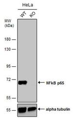 NFkB p65 Antibody