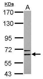 CPNE6 Antibody in Western Blot (WB)