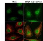 Cofilin Antibody in Immunocytochemistry (ICC/IF)