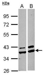 AKR1A1 Antibody in Western Blot (WB)