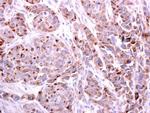 PDCD6 Antibody in Immunohistochemistry (Paraffin) (IHC (P))