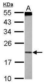 PDCD6 Antibody in Western Blot (WB)