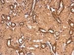 PPP2R1A Antibody in Immunohistochemistry (Paraffin) (IHC (P))