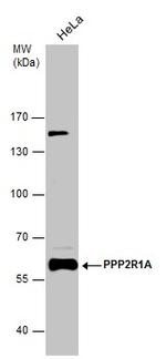 PPP2R1A Antibody in Western Blot (WB)