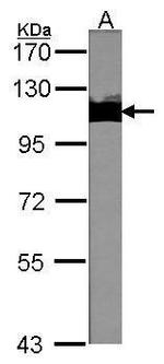 TRIM28 Antibody in Western Blot (WB)