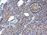 TRIM28 Antibody in Immunohistochemistry (Paraffin) (IHC (P))